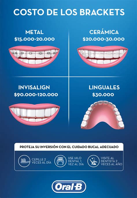 precio brackets metalicos ortodoncia|cuanto cobran por poner brackets.